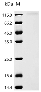 SDS-PAGE