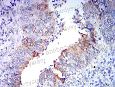 Валидация AntibodySystem RHE34707