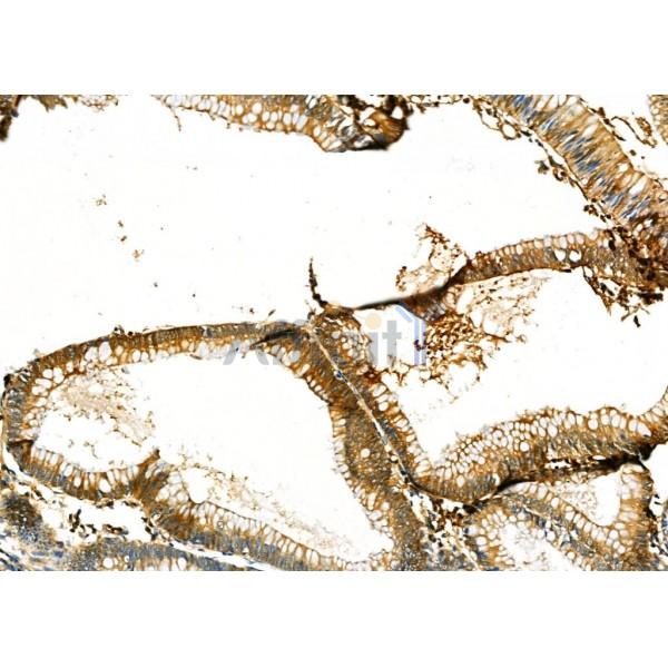 Валидация Affinity DF6691 - 18192