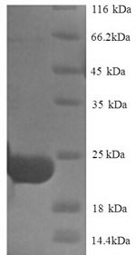 SDS-PAGE