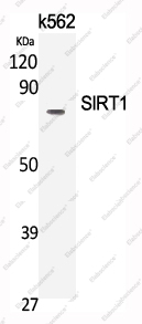 Вестерн-блоттинг, SIRT1, клетки K562
