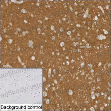 Валидация AntibodySystem RHF71701