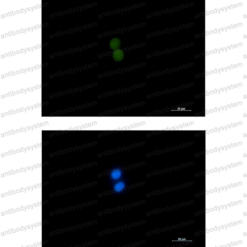 Валидация IF - AntibodySystem RHK65802