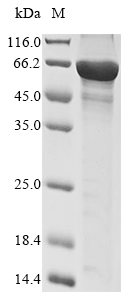 SDS-PAGE