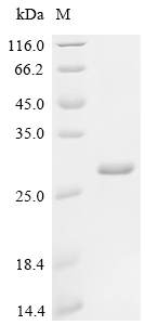 SDS-PAGE