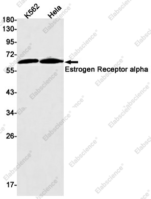 Вестерн-блоттинг, Estrogen Receptor alpha, клетки K562 и HeLa
