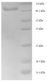 SDS-PAGE