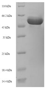SDS-PAGE