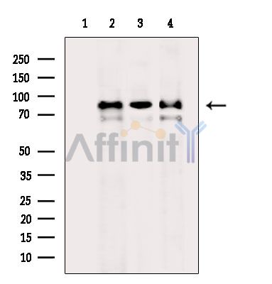 Валидация Affinity DF14185 - 9998