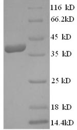 SDS-PAGE