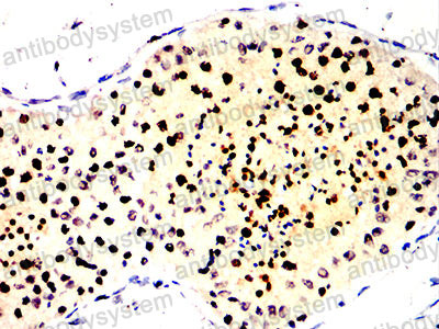 Валидация AntibodySystem RHN99001 (4040)