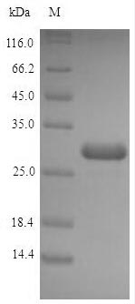SDS-PAGE