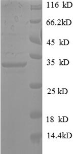 SDS-PAGE