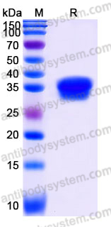 EHJ99001, SDS-PAGE
