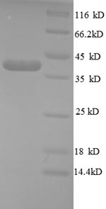 SDS-PAGE