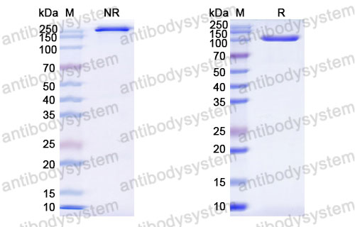 Валидация SDS-PAGE - AntibodySystem DHF19802