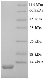 SDS-PAGE