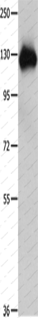 Вестерн-блоттинг, Amphiphysin I, ткань легкого мыши