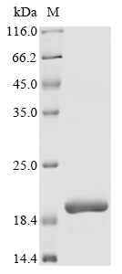 SDS-PAGE