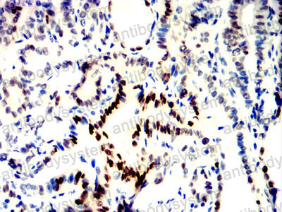 Валидация AntibodySystem RHN99401