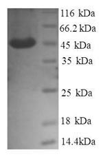 SDS-PAGE