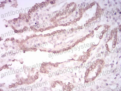 Валидация AntibodySystem RHC99509