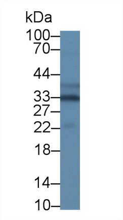 14195