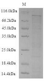 SDS-PAGE