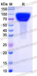 EHN20601, SDS-PAGE