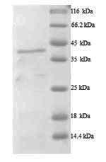 SDS-PAGE