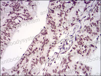 Валидация AntibodySystem RHA07203