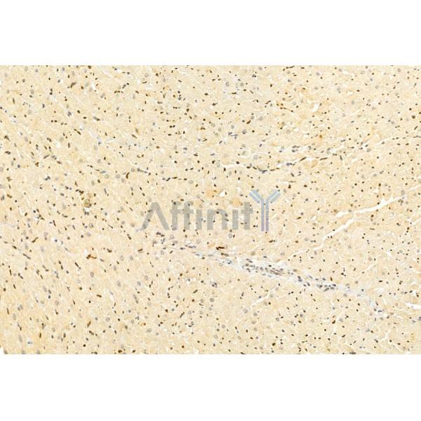 Валидация Affinity DF12008 - 6010