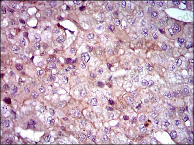 Валидация AntibodySystem RHH10702