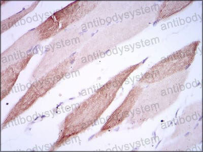 Валидация AntibodySystem RHG64003