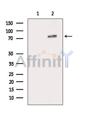 Валидация Affinity DF14984 - 11187