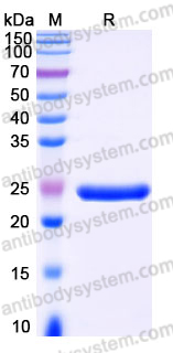 YHH21701, SDS-PAGE