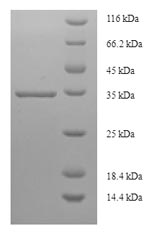 SDS-PAGE