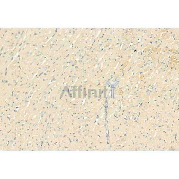 Валидация Affinity AF6477 - 3804