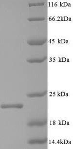 SDS-PAGE