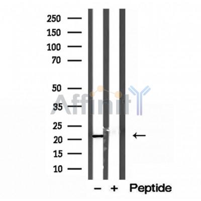 Валидация Affinity DF12156 - 6347