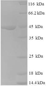SDS-PAGE