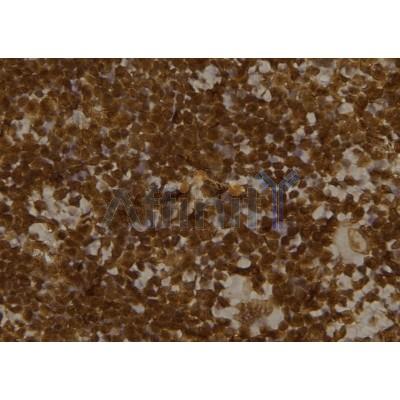 Валидация Affinity DF6204 - 17464