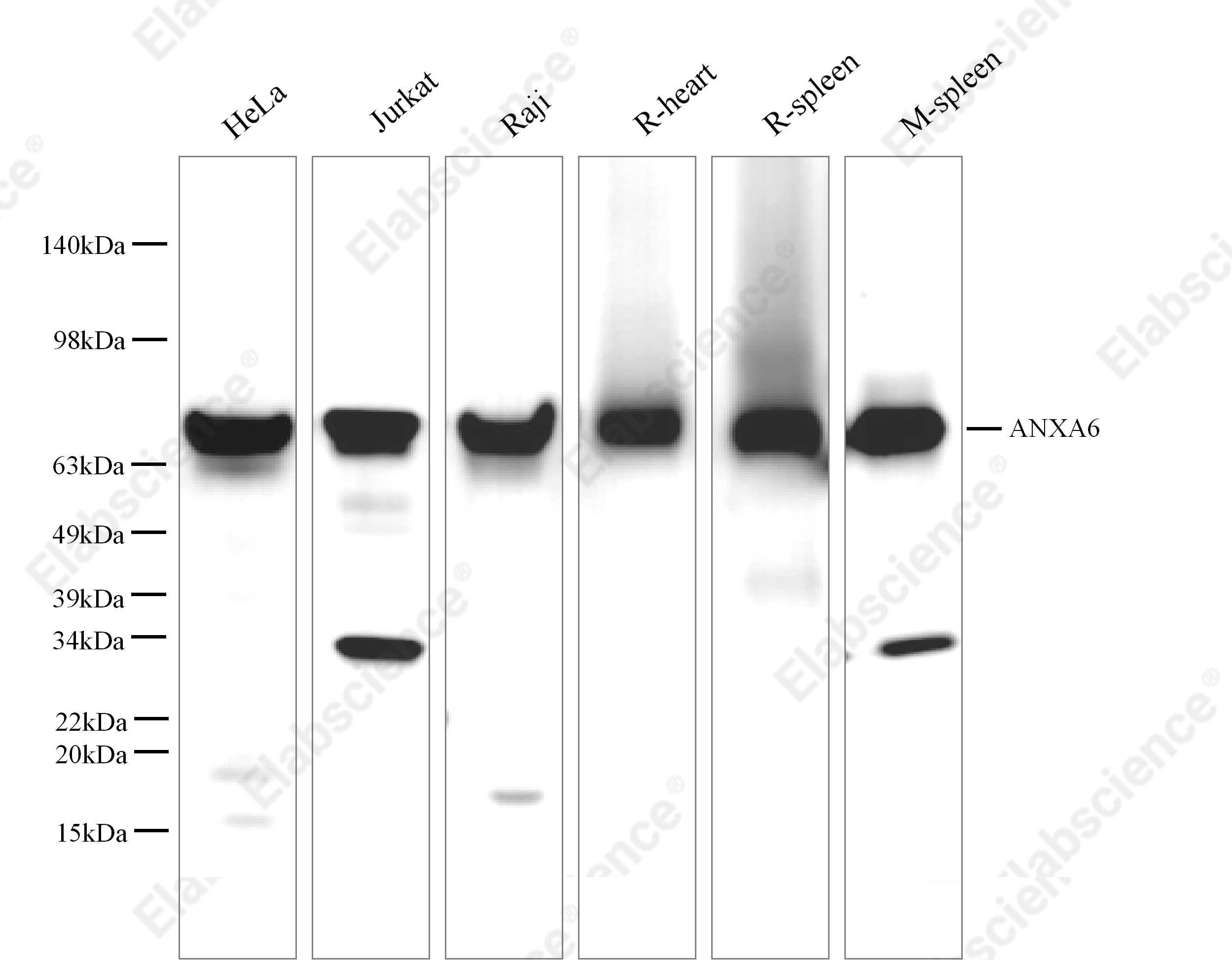 Вестерн-блоттинг, ANXA6, ткань семенников и селезенки крысы
