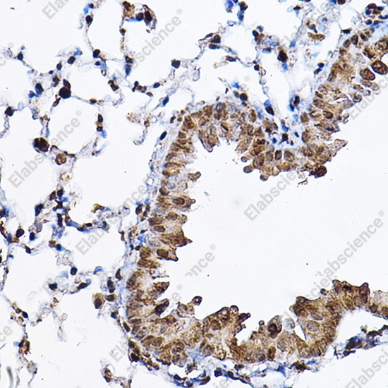 Иммуногистохимия, p70 S6 Kinase 1, ткань легкого мыши