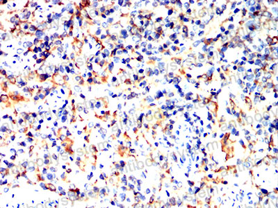 Валидация AntibodySystem RHJ16301 (3346)