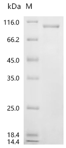 SDS-PAGE