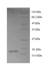 SDS-PAGE