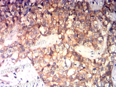 Валидация AntibodySystem RHD03605 (1289)