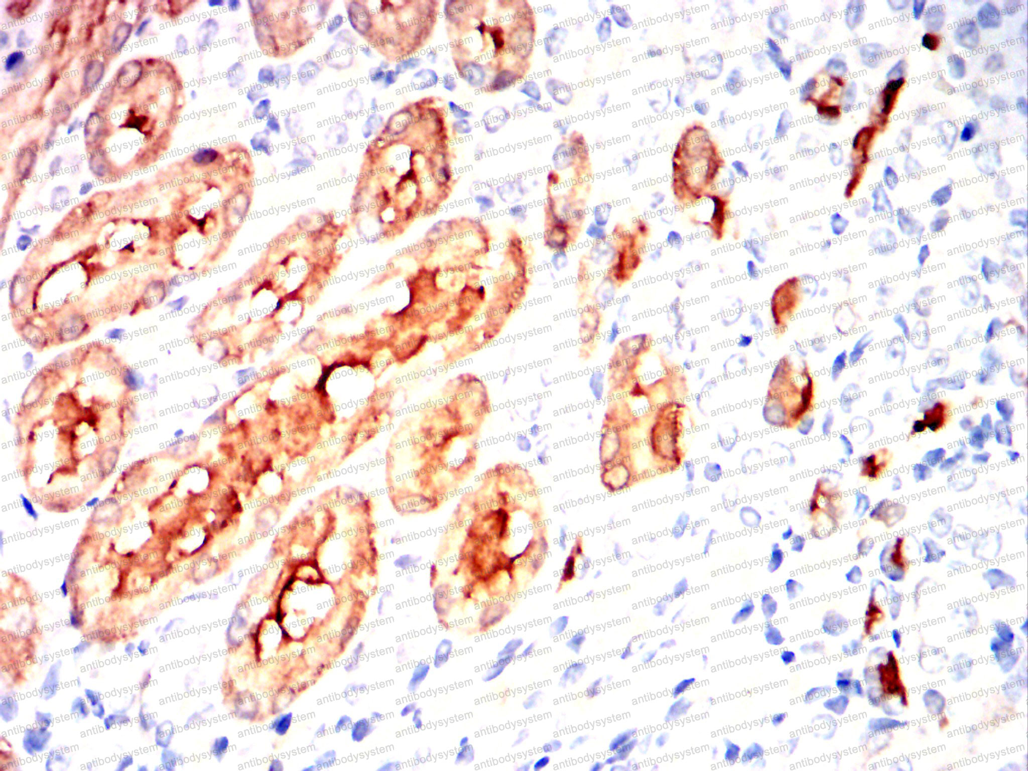 Валидация AntibodySystem RHE94902 (2408)