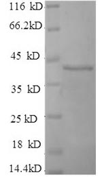 SDS-PAGE